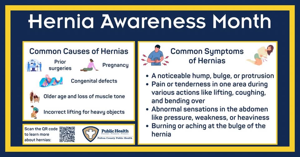 Hernia Awareness Month. Common Causes of Hernias :Prior surgeries, Pregnancy, Congenital defects, Older age, and loss of muscle tone, Incorrect lifting for heavy objects. Common Symptoms of Hernias: A noticeable hump, bulge, or protrusion; Pain or tenderness in one area during various actions like lifting, coughing, and bending over; Abnormal sensations in the abdomen like pressure, weakness, or heaviness; Burning or aching at the bulge of the hernia.